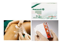 SUPRASORB F 5X7CM 10PZ-906266313